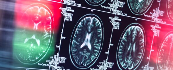 Brain Scans